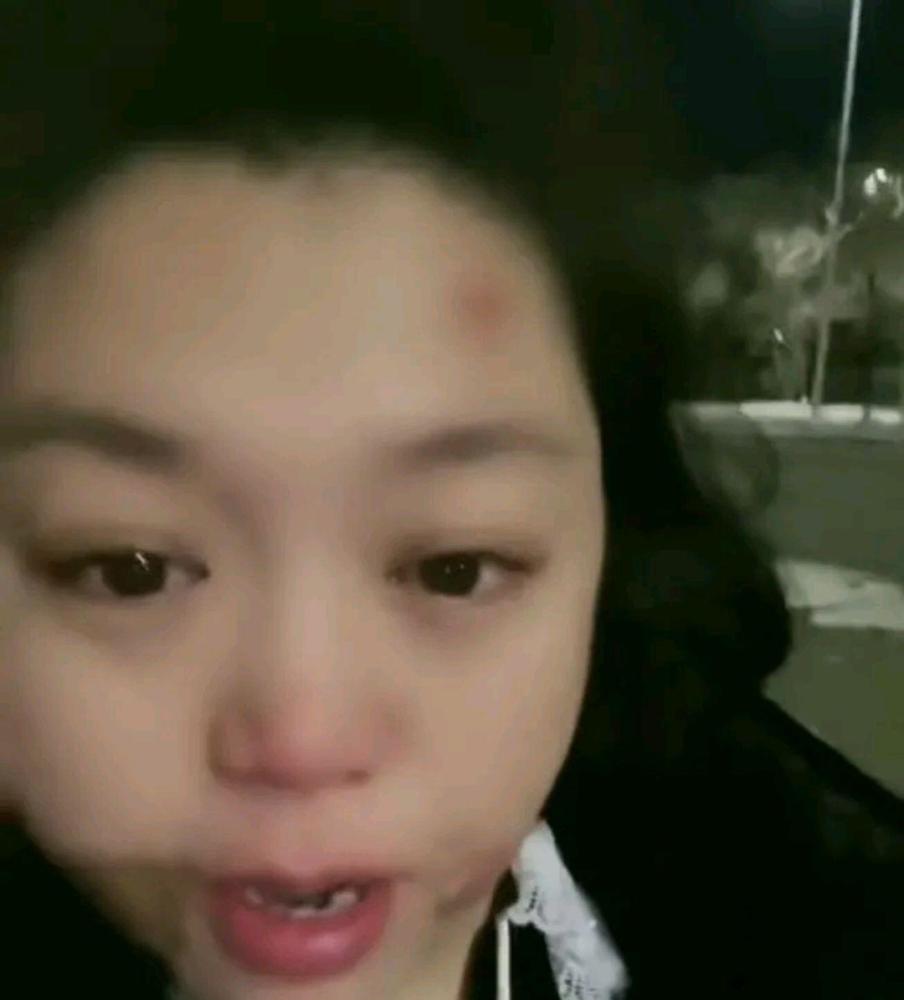 二人转小黄飞脸被打淤青疑似跟斯卡拉老板姜鹏老师闹掰了