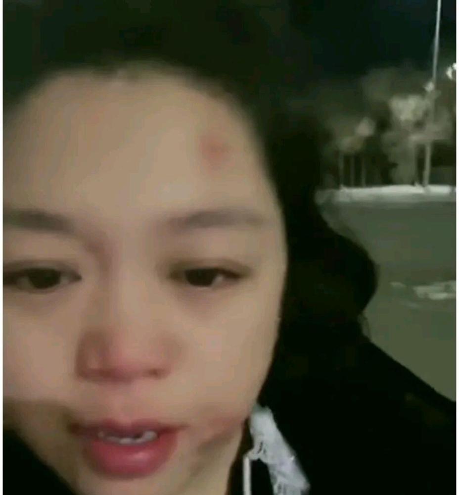 二人转小黄飞脸被打淤青疑似跟斯卡拉老板姜鹏老师闹掰了