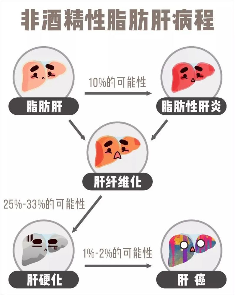 從脂肪肝到肝癌只有四步學會這幾點教你逆轉脂肪肝