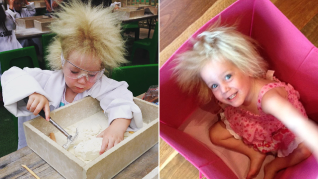 杀马特发型原来是种罕见疾病澳洲小女孩坦然接受了反正我自己看不到