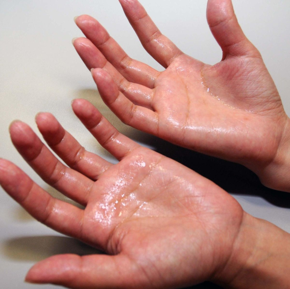 手汗"多如雨下",你有这种困扰吗?五种方法送给你_腾讯新闻