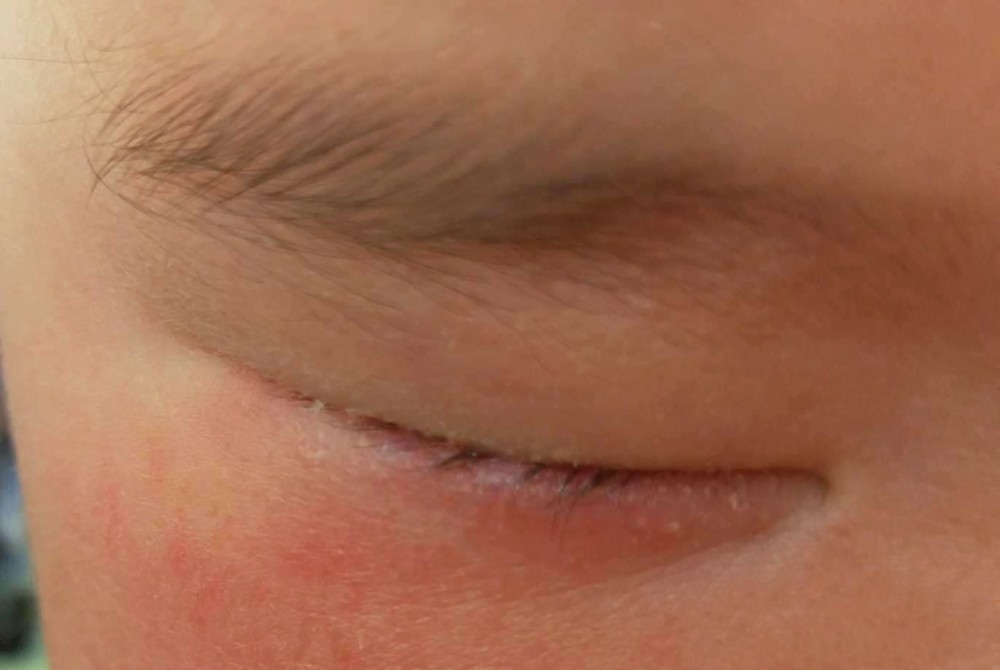 新生儿视力孱弱很怕光,四种常见光源威力很大,妈妈却毫不知情_腾讯