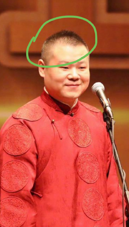 岳云鹏新造型秃顶严重网友坦言有点吓人再也不像吴彦祖了