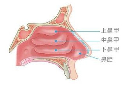 濰坊耳鼻喉醫院鼻甲肥大要如何治療