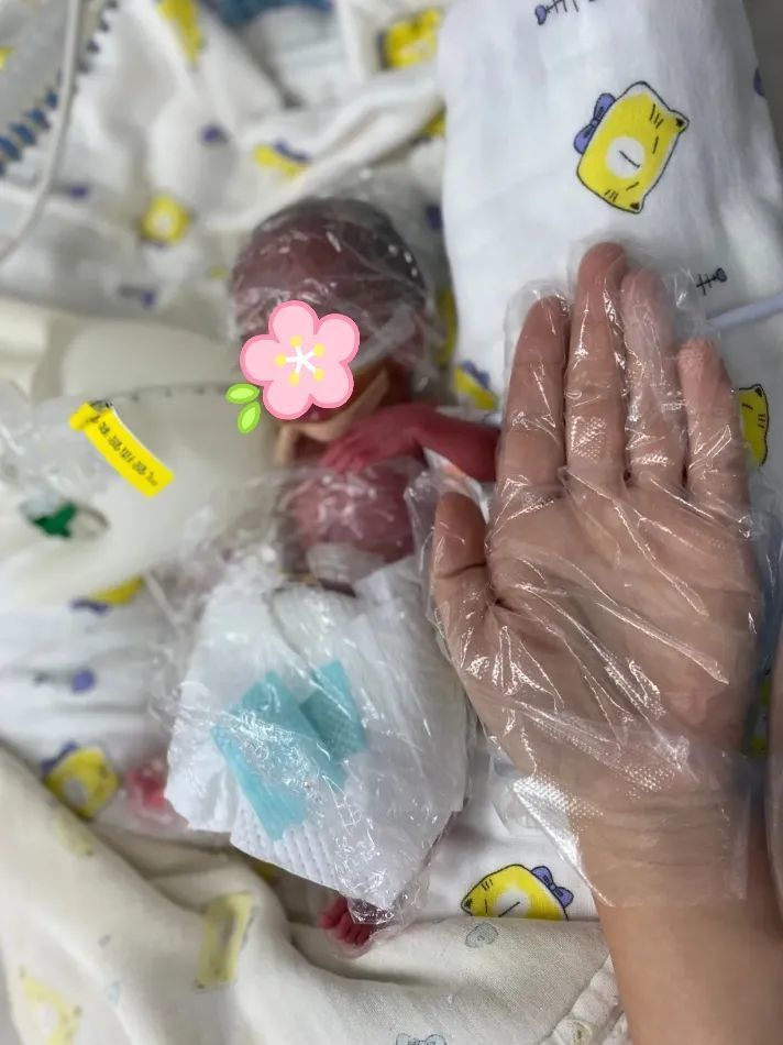 11月7日12时许,37岁的高龄产妇王女士因"重度子痫前期,胎儿宫内窘迫等