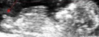 怀孕十二周胎儿性别不同孕妈会有哪些真实反应 看看过来人的说法 腾讯新闻