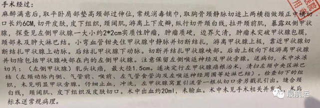 写在甲状腺癌术后40天 癌细胞淋巴转移 健康养生防扩散中 最航运 淋巴转移 甲状腺癌 癌细胞 甲状腺
