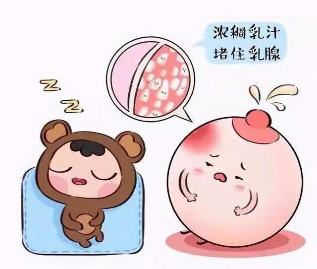 门诊小故事哺乳期乳腺炎莫惊慌