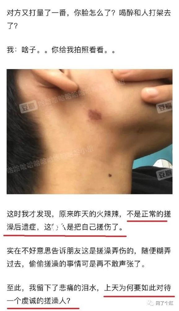 無意間發現男朋友脖子草莓印結果哈哈哈哈這是個狠人