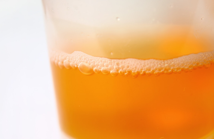 肾病|肾病，盯上年轻人，这5个行为，再难也要改，哪怕能改掉一个也好