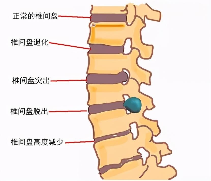 治療頸椎腰椎病大連這家中醫骨科不簡單