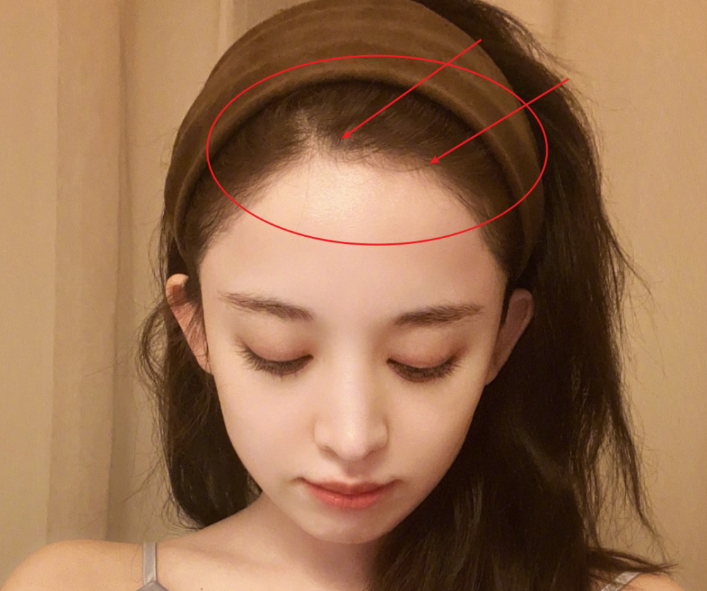 古力娜扎晒真实发际线照,网友却再次质疑鞠婧祎!_腾讯新闻