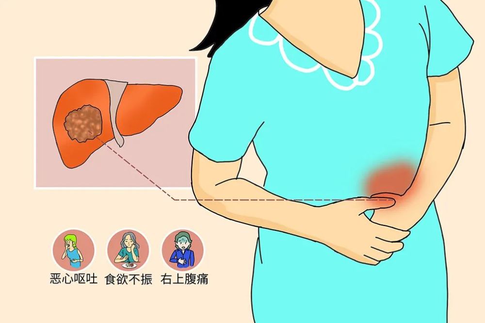 无压痛,表面光滑或不光滑,在包块部位听诊时,偶可听到传导性血管杂音