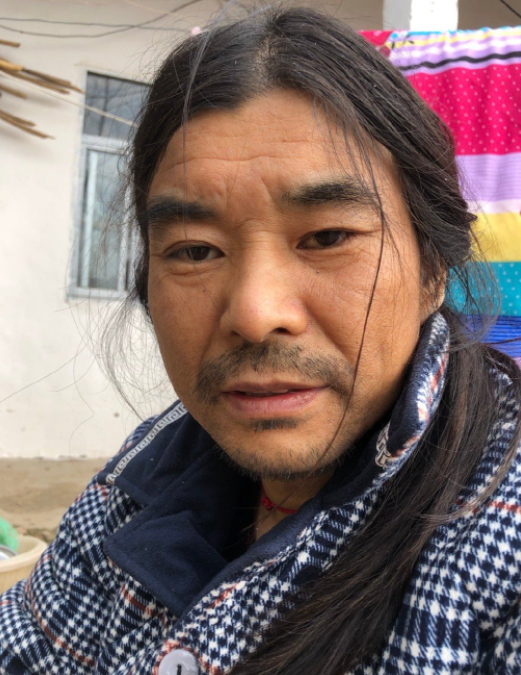 被癌症砸中的"面筋哥",至今放心不下女儿,他的现状又是如何?