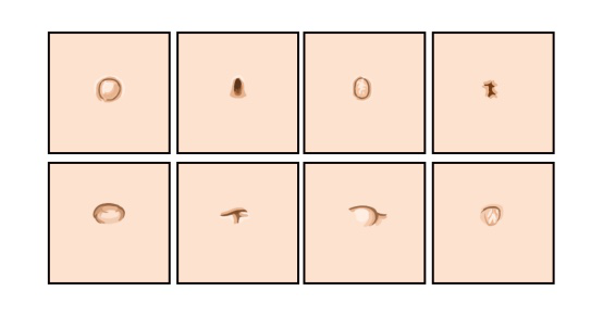 肚脐眼长得难看,是不是医生手艺不好?_腾讯新闻