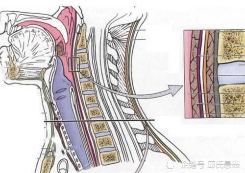 颈椎间盘突出会引起哪些症状 邱颈椎 腾讯新闻