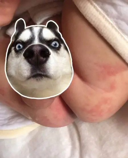 你做好这几点就不会有尿布疹,孩子不正常睡觉你知道这几点吗