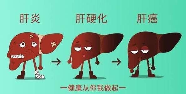 肝硬化下一站就是肝癌肝硬化有什麼症狀能治好嗎還能活多久