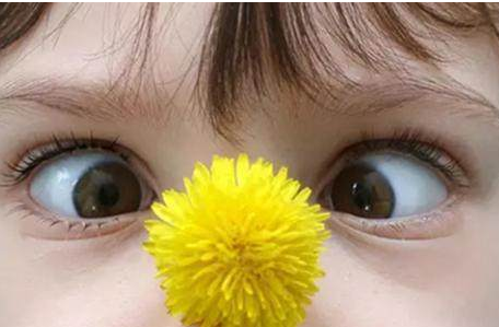 南坪爱尔眼科陈春梅主任解释道,斜视俗称"对眼","瞟眼",是由于双眼视