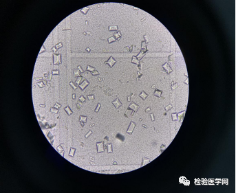 磷酸銨鎂結晶草酸鈣結晶多來自食物及機體的正常代謝,一般無臨床意義.