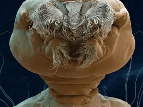 在3000倍显微镜下的 细菌 它到底长啥样 非常像小怪兽 寄生虫 猫咪 猫跳蚤