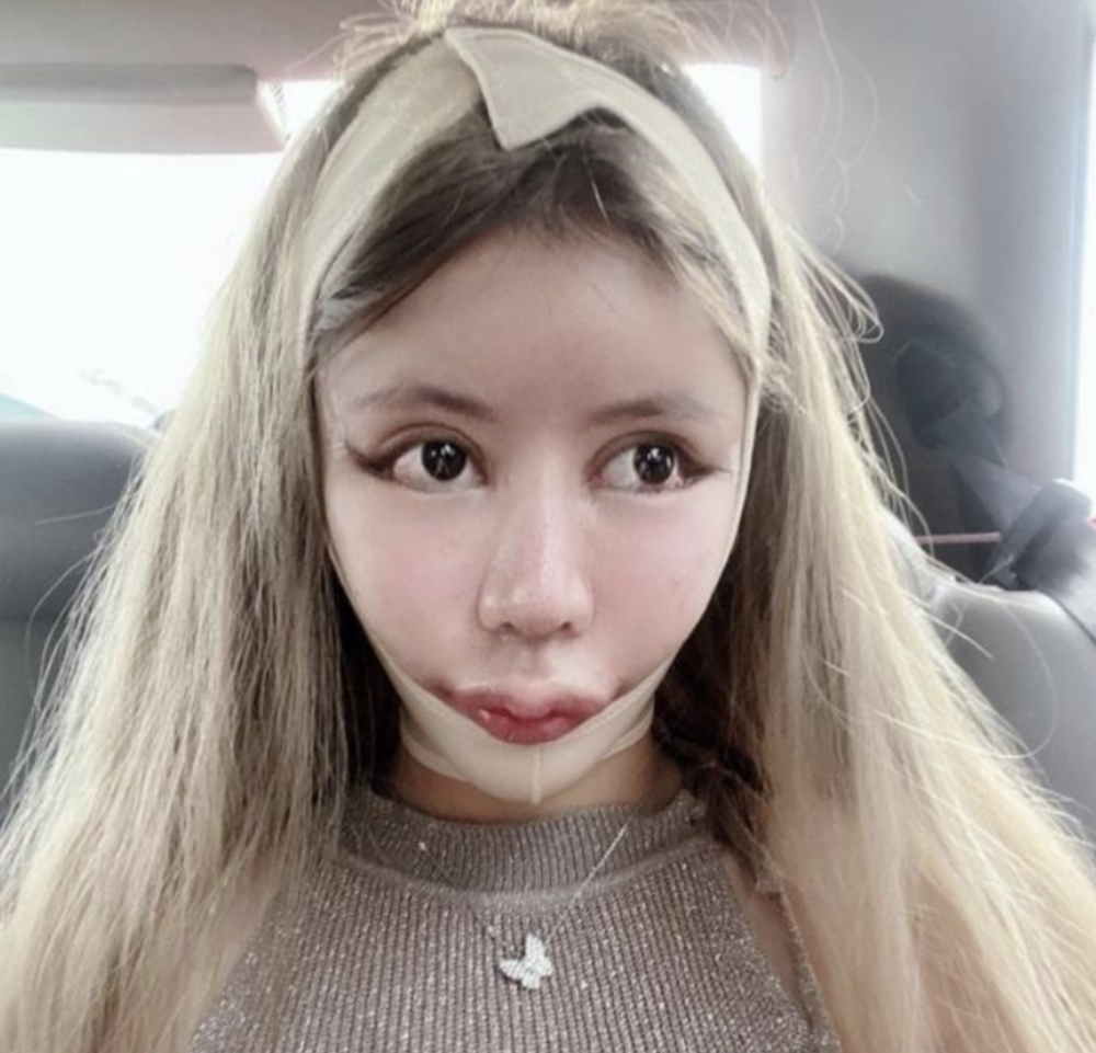 13岁开始整容,砸50万整成"芭比娃娃",如今的脸一言难尽