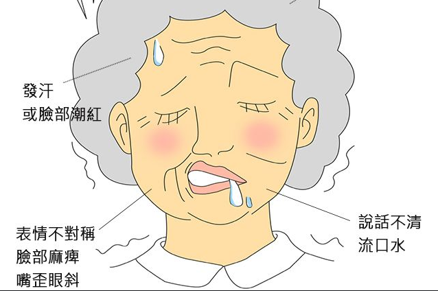 脑中风到来不突然这些马脚你要提前知