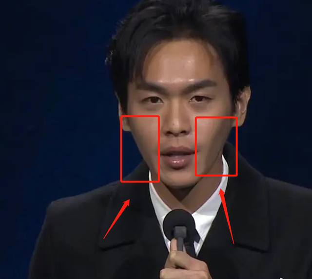 张若昀双颊凹陷气色差,瘦到脱相,还是蹭月子餐胖了十斤的他吗?