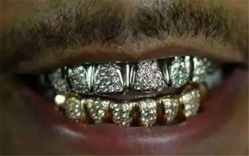 第二件比较奢华的事呢,就是三球最近给自己镶了一口钻石牙,效果简直是