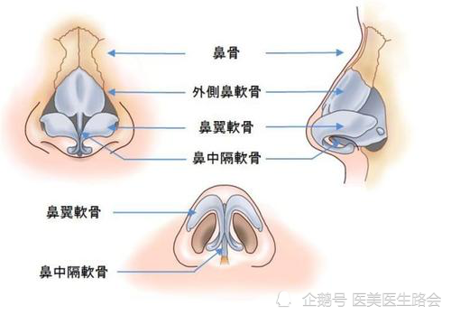 什么是 鼻骨内推 这种手术方式真的适合所有 宽鼻 的人吗 腾讯网