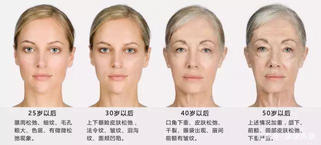 什么是热老化？夏季如何预防肌肤热老化？(什么是热老化?夏季如何预防肌肤热老化的方法)-第2张图片-鲸幼网