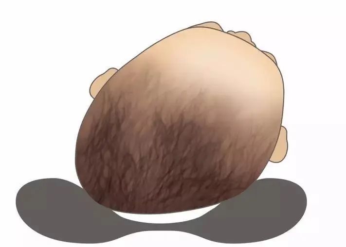 睡早了或睡不当,都可能坑娃!