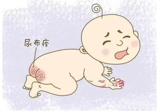 宝宝老是反复的红屁屁怎么回事多半是护理不当这样做才正确