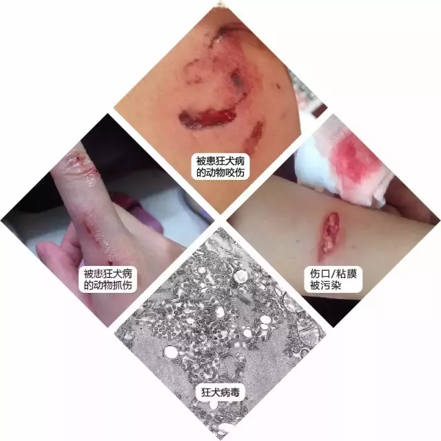 狂犬病是狂犬病毒属病毒感染引起的一种急性脑炎,是动物源性传染病.