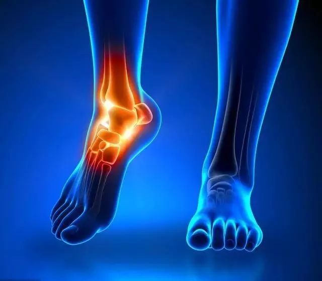 学会这几招可以缓解90的足跟痛