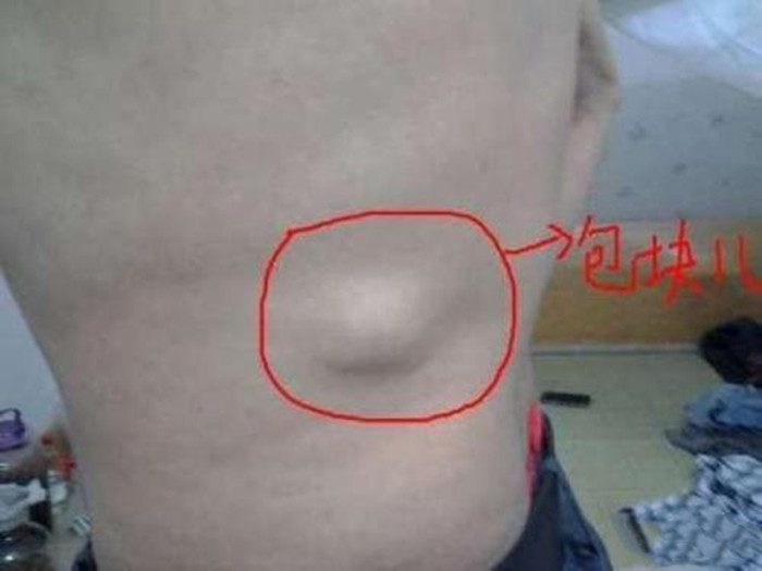 这5种身体表现如果原因不是很明确那估计是癌症的表现