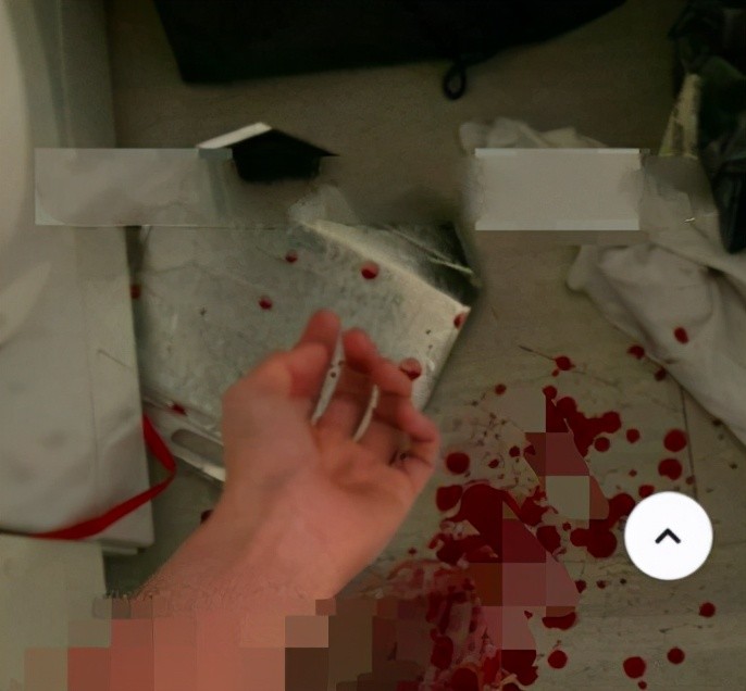 朴有天前女友晒割腕照血流一地触目惊心疑与百万豪车被偷有关