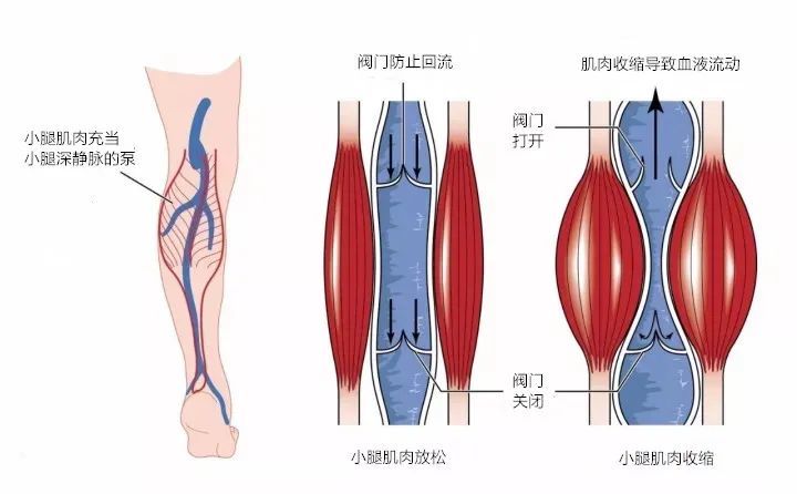 主要依靠下肢肌肉在运动时的肌肉挤压作用,特别是小腿肌肉的挤压作用