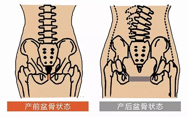 产后42天后到产后半年内,这个时间段被称为产后骨盆恢复的黄金时间段.