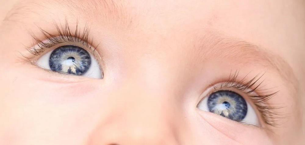 1218宝宝有一双水汪汪的大眼睛未必是好事