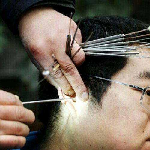 重庆72岁大爷路边采耳花1600元儿子报警师傅叫苦70年结石不好掏