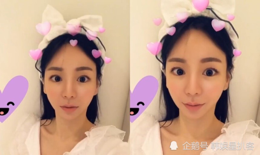 朴有天前女友南阳乳业外孙女自残引起轩然大波,手腕伤痕累累触目惊心