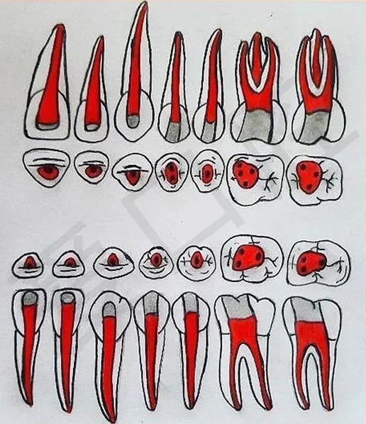 牙齿开髓位置及洞型干货 根管治疗心得体会分享根