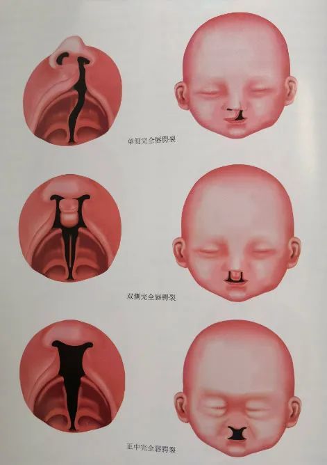 鄭女士在現代婦產超聲科,通過四維彩超篩查出腹中21周3天的寶寶心臟