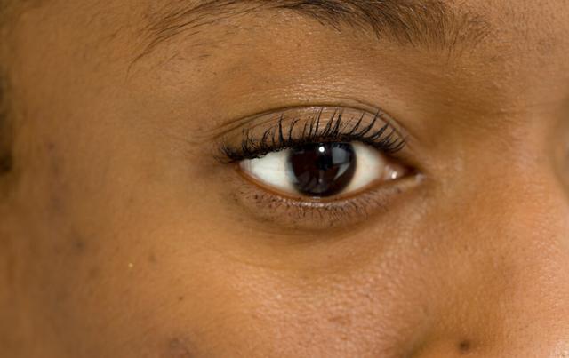 29岁女子确诊肝癌,3月后离世,医生:脸上早有提醒,她忽视了_腾讯新闻