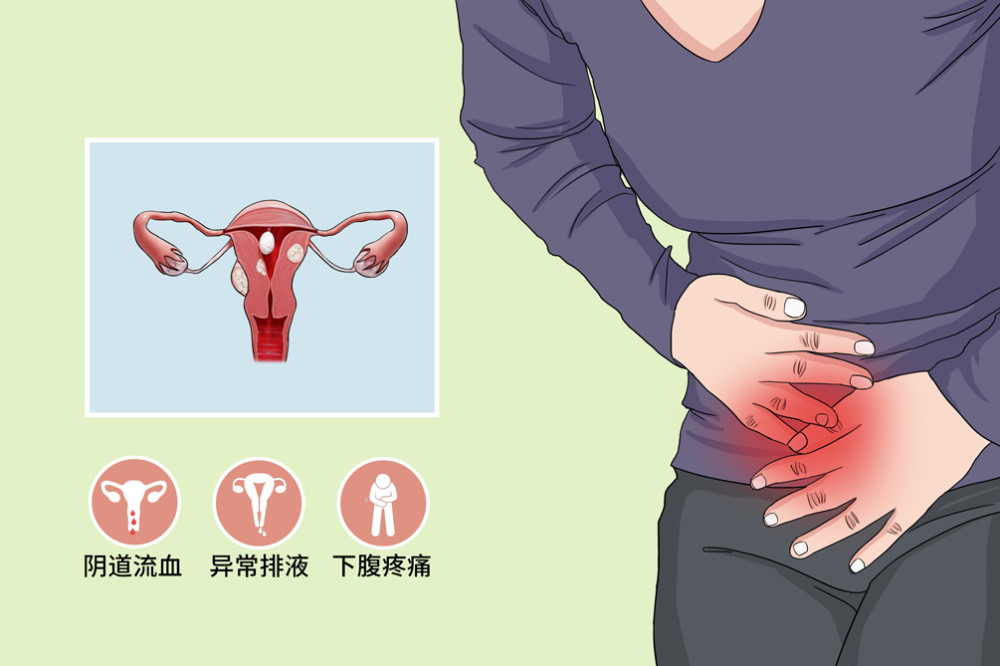 子宫癌是发生于子宫内膜的一组上皮性恶性肿瘤,发生在子宫内膜上皮,绝