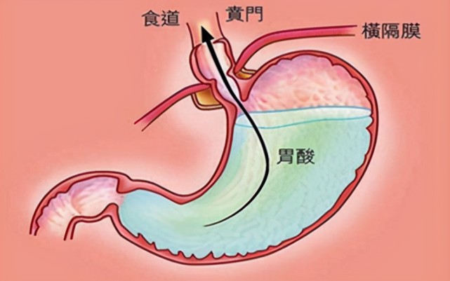 食物从吃进去到排出来需要多久又经历了怎样的旅行