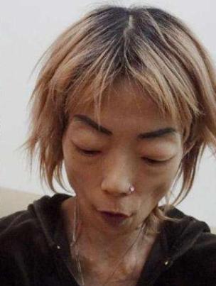 放弃牛津当阔太的伍智恒,婚后全身瘫痪牙齿脱落:一入豪门深似海