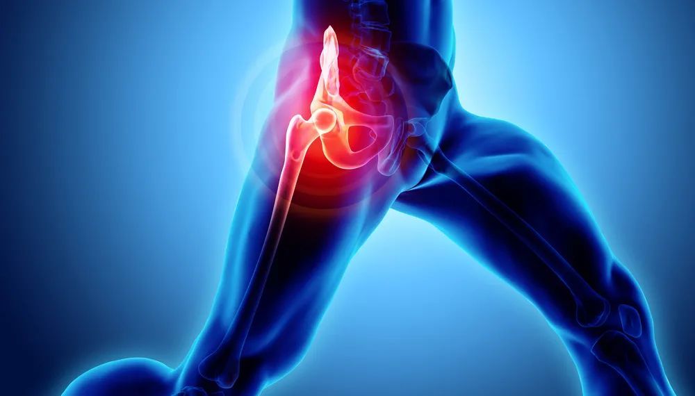 髋关节人体最怕摔的部位5类人的胯格外脆