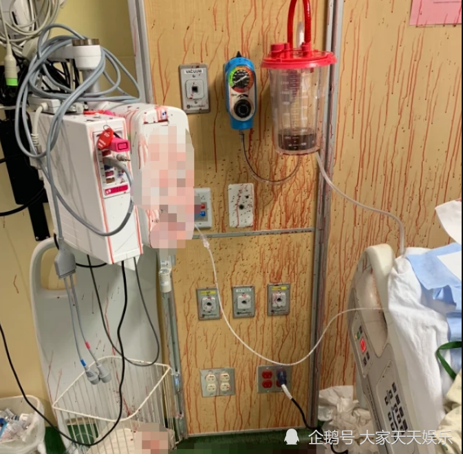 美国少年确诊新冠身亡临终前喷血-WordPress极简博客